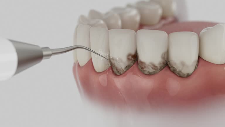 Trusted Teeth Cleaning And Checkup service in Boiling Springs, NC - Dentist Open Now
